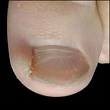 ongle