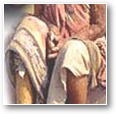 lèpre.jpg